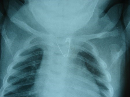 safety pin in x-ray